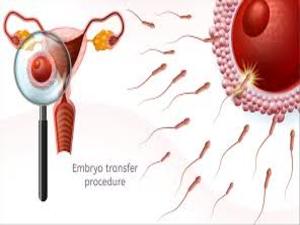 Embryo Transfer KNOW MORE