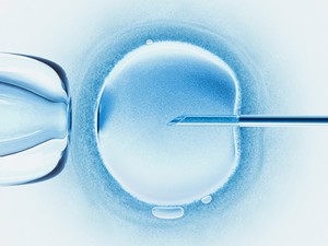 Egg Freezing  KNOW MORE
